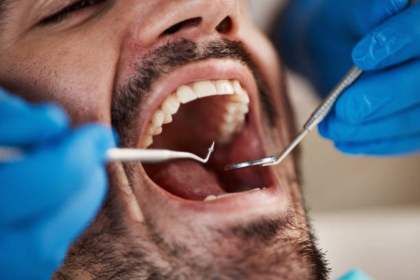 Best Knocked-Out Tooth Emergency  in Madera Ranchos, CA